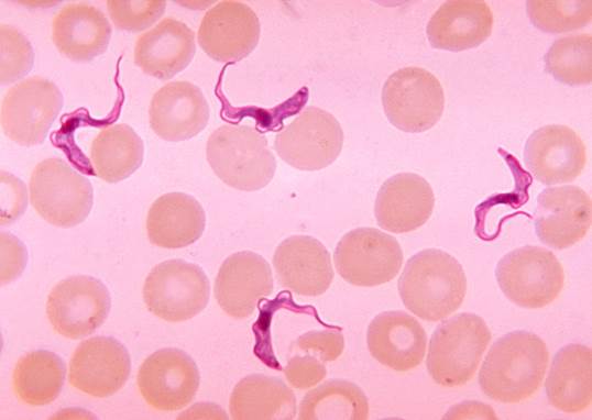 http://lanochedelosinvestigadores.fundaciondescubre.es/files/2016/07/Trypanosoma_sp._PHIL_613_lores.jpg